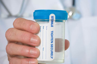 PIC2 DRUG URINE TESTS